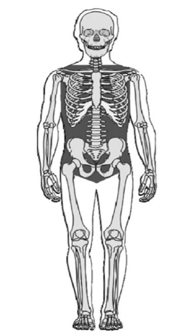 skeleton with non-compressible hemorrhage areas