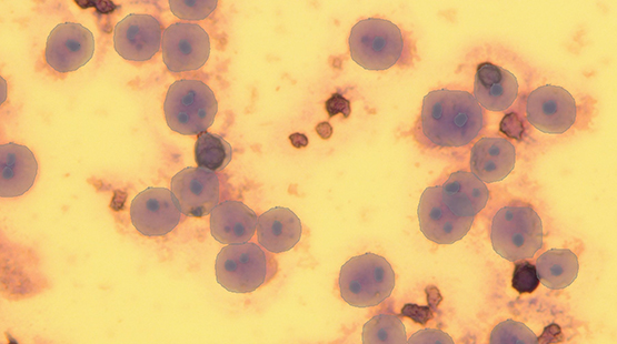 cell boundaries are more accurate and almost all nucleoli are correctly labeled.