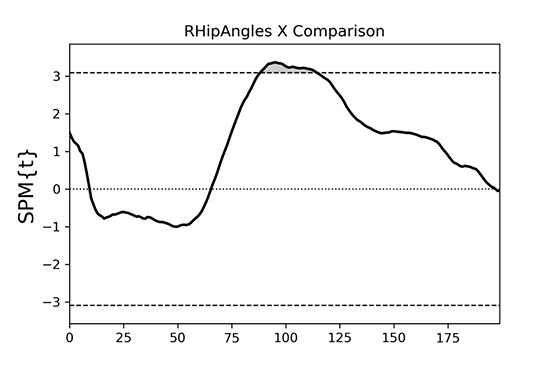 graph showing statistical differences in hip joint motion between injured and non-injured groups