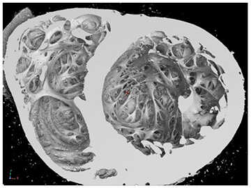 Surface rendering of the inside of the heart looking toward apex of the heart with the left ventricle on the right side 