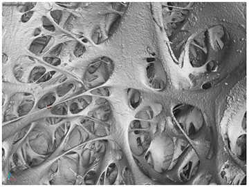 Visualization of inside the left ventricle near the apex