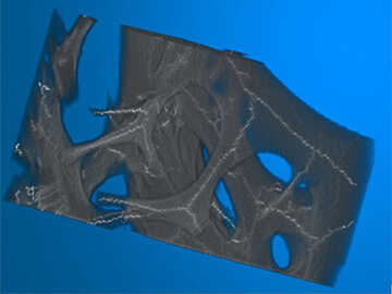 Visualization of calculated skeleton (light traces) within a subset of trabecular volume