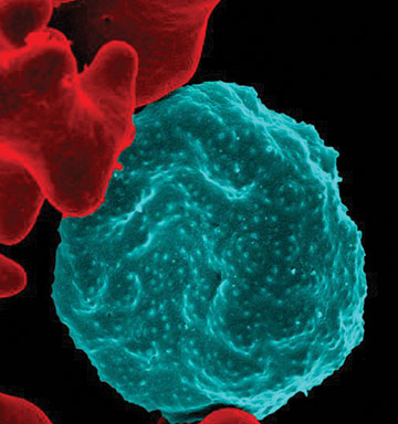 an infected blood cell colored blue surrounded by red blood cells