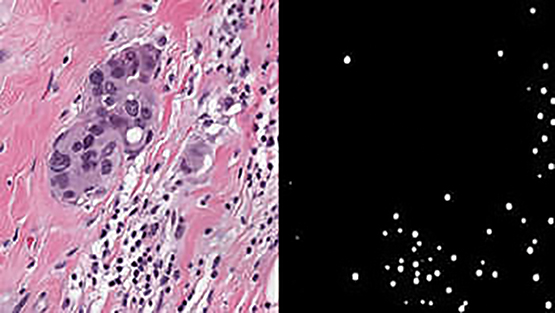 a detection algorithm using breast cancer tumor cell images to compete in BreastPathQ: Cancer Cellularity Challenge