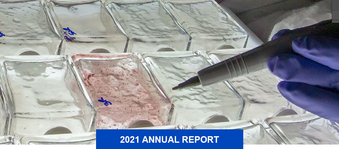 Microbial activity in stored fuel.