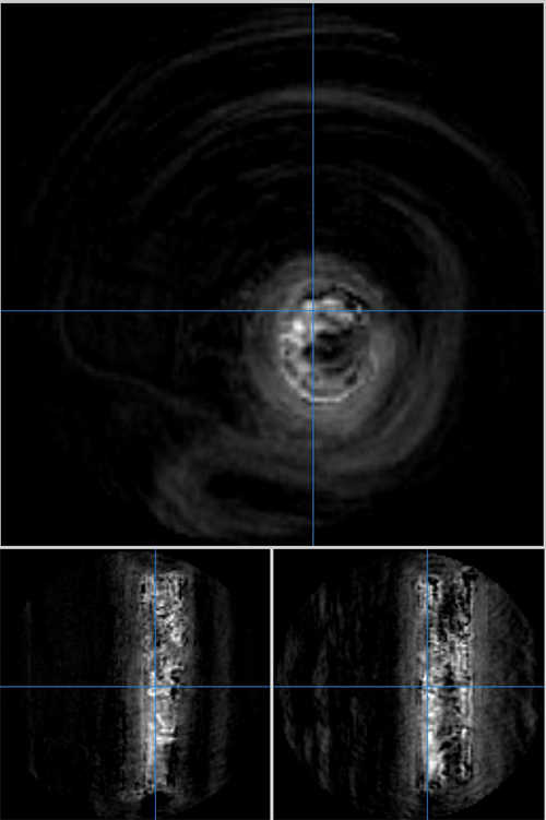 3 MRI images of frozen baboon femur showing microdamage and water in bone