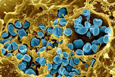 Microscopic image of blue bacteria infecting a mouse immune cell