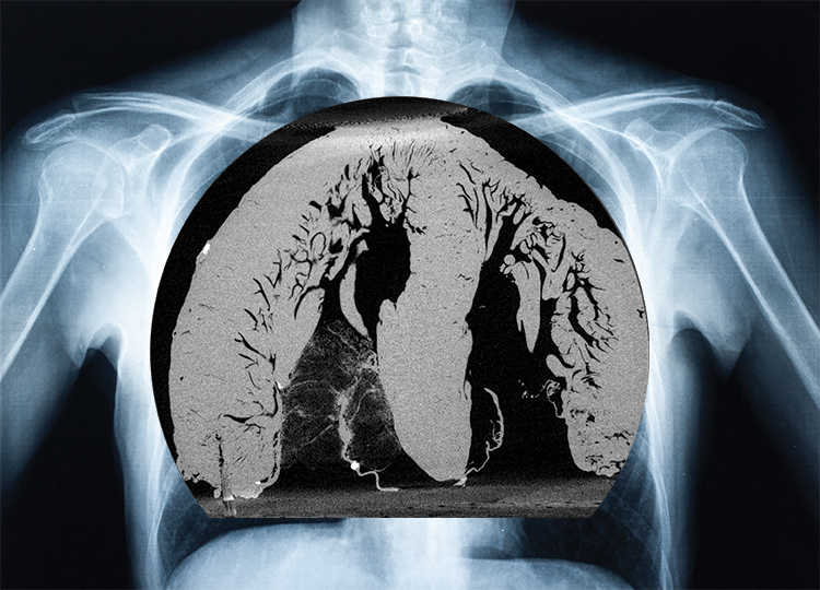 ct scan of human heart laid over x-ray of human chest
