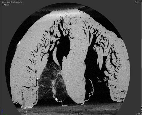 Computer model of the tubular structures in the human heart