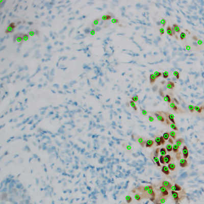 ER stained cells identified by the neural network, with green circles representing correctly identified cells.