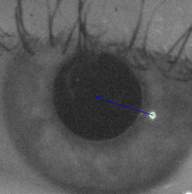 human eye with a green circle indicating the center of the near infrared glint and a blue circle indicating center of the pupil.